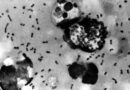 US monitoring suspected fatal pneumonic plague case in Russia, State Department official says