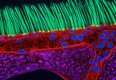 Nikon microscopic video competition winner disqualified for using generative AI